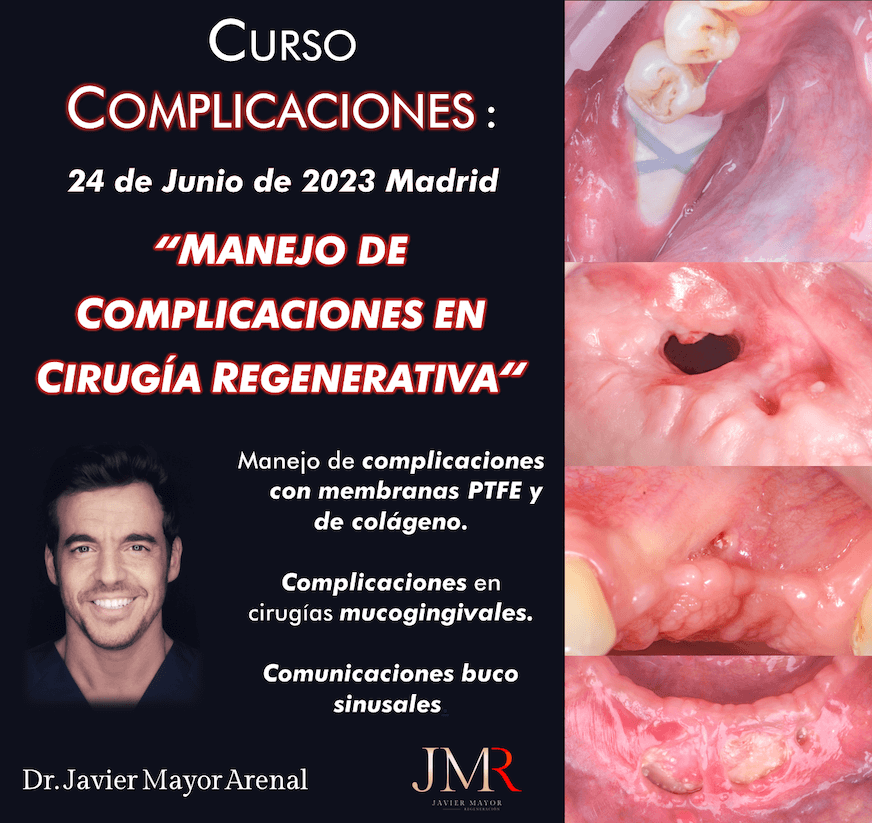 curso-complicaciones-cirugia-regenerativa-junio-2023-madrid-dr-javier-mayor-arenal
