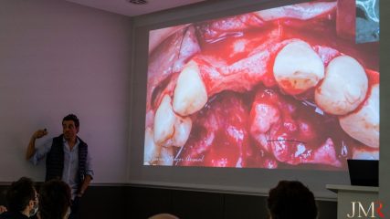 Curso Regeneración Ósea Guiada - Clínica Borg Center Barcelona 2022