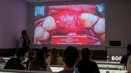 Curso Regeneración Ósea Guiada - Clínica Borg Center Barcelona 2022