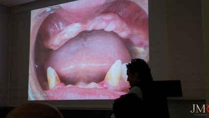 Curso Regeneración Ósea Guiada - Clínica Borg Center Barcelona 2022