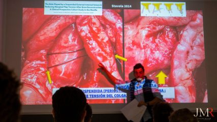 Curso Regeneración Ósea Guiada - Clínica Borg Center Barcelona 2022