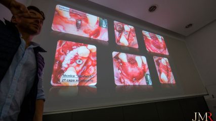 Curso Regeneración Ósea Guiada - Clínica Borg Center Barcelona 2022