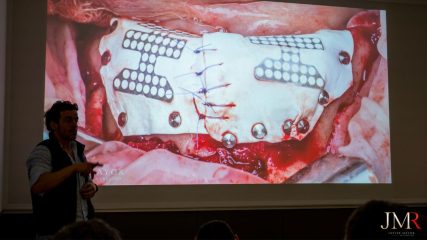 Curso Regeneración Ósea Guiada - Clínica Borg Center Barcelona 2022