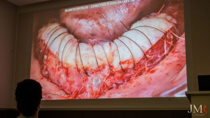 Curso Regeneración Ósea Guiada - Clínica Borg Center Barcelona 2022