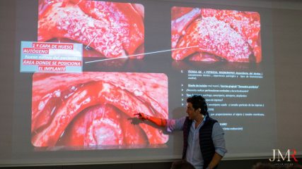 Curso Regeneración Ósea Guiada - Clínica Borg Center Barcelona 2022