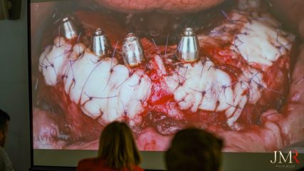 Curso Modular de Regeneración Ósea JMR 2022