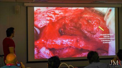 Curso Modular de Regeneración Ósea JMR 2022