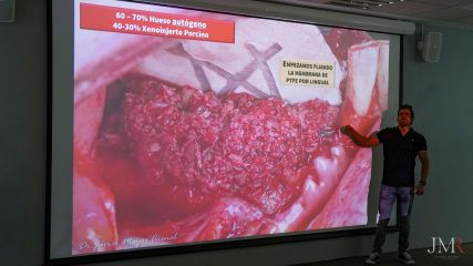 Curso Modular de Regeneración Ósea JMR 2022