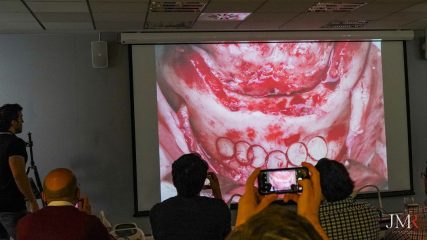 Curso Modular de Regeneración Ósea JMR 2022