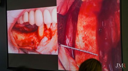 Curso Modular de Regeneración Ósea JMR 2022
