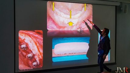 Curso Modular de Regeneración Ósea JMR 2022