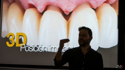 Curso-implantologia-estetica-2024